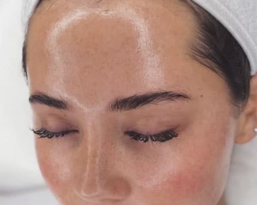 Radiofrecvență - 6