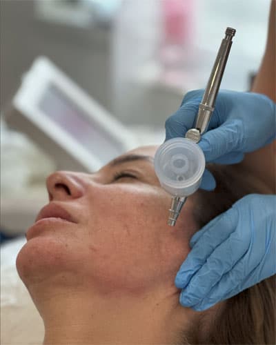 Oxigenare Facială - OxygenEra Pro - 6