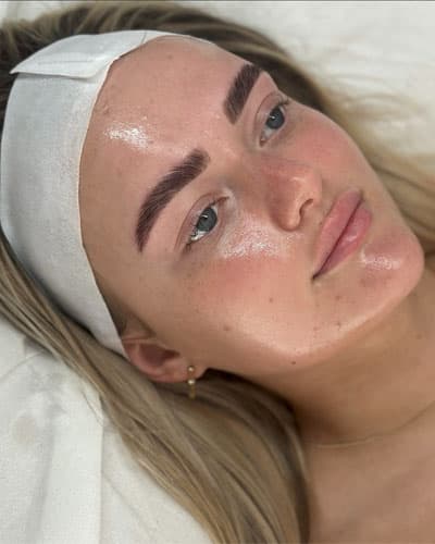 Oxigenare Facială - OxygenEra Pro - 7