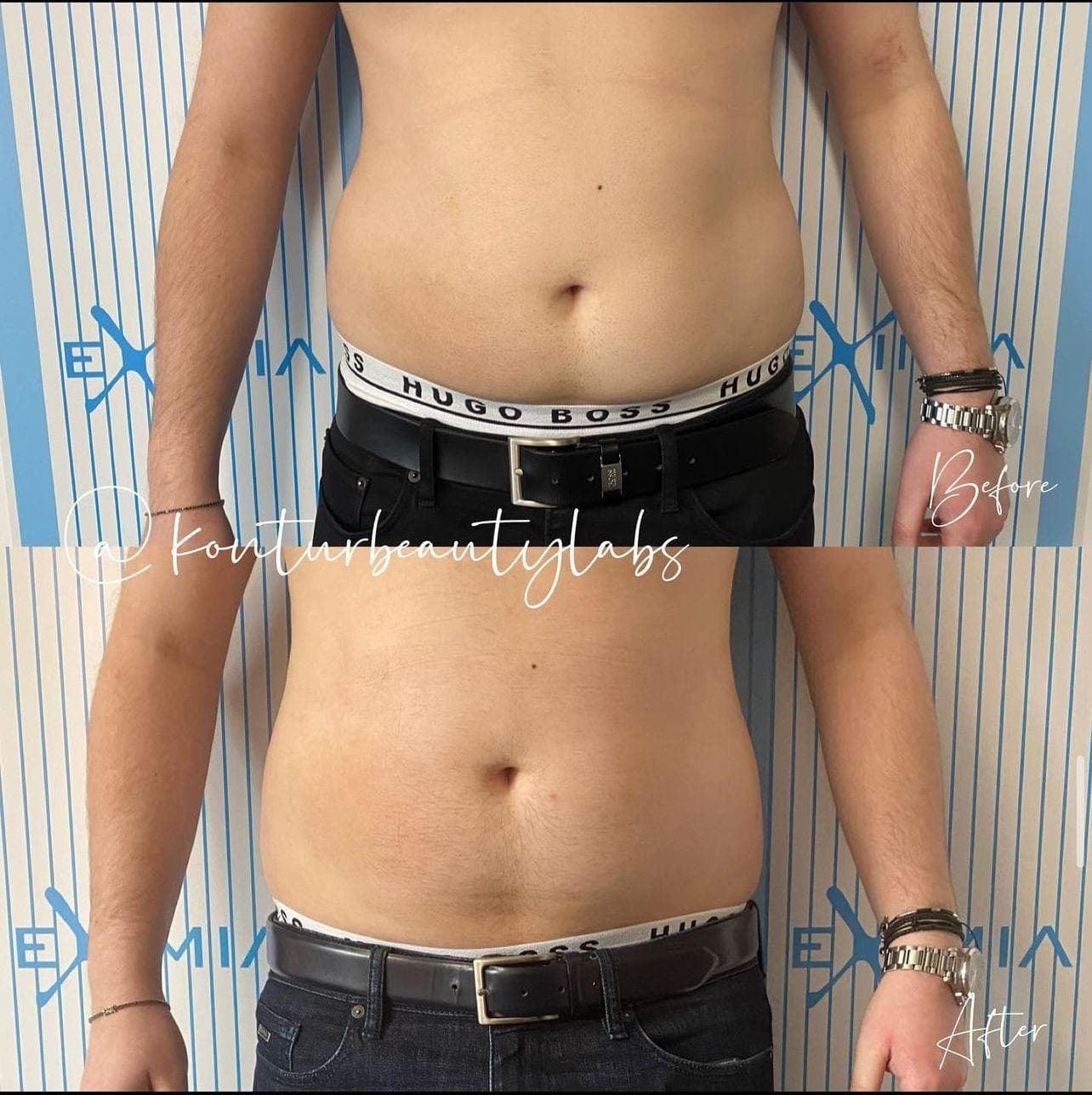 Tratament Eximia Bucuresti - 10