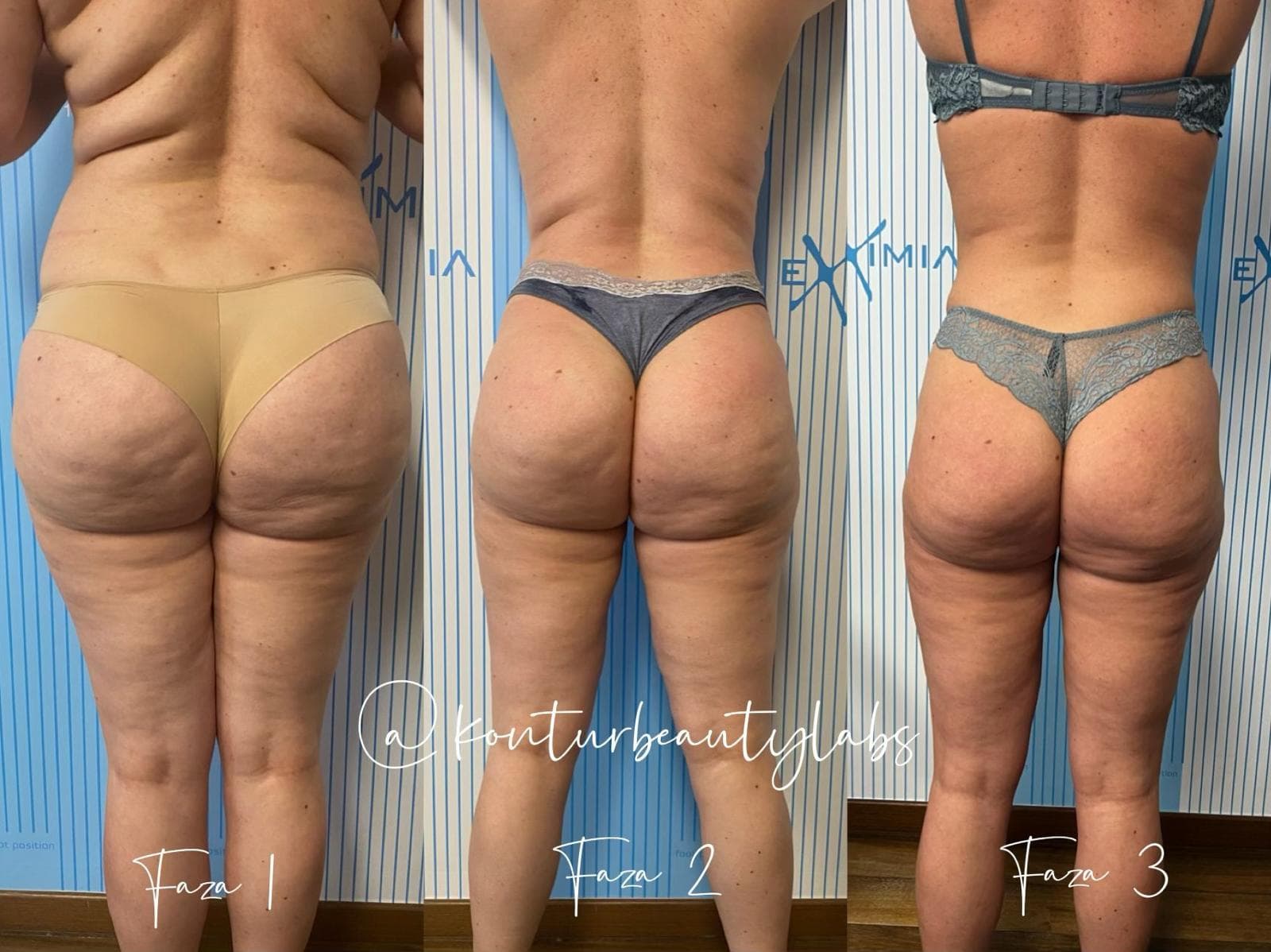 Tratament Eximia Bucuresti - 11