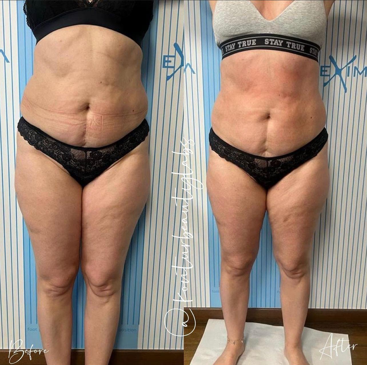 Tratament Eximia Bucuresti - 12