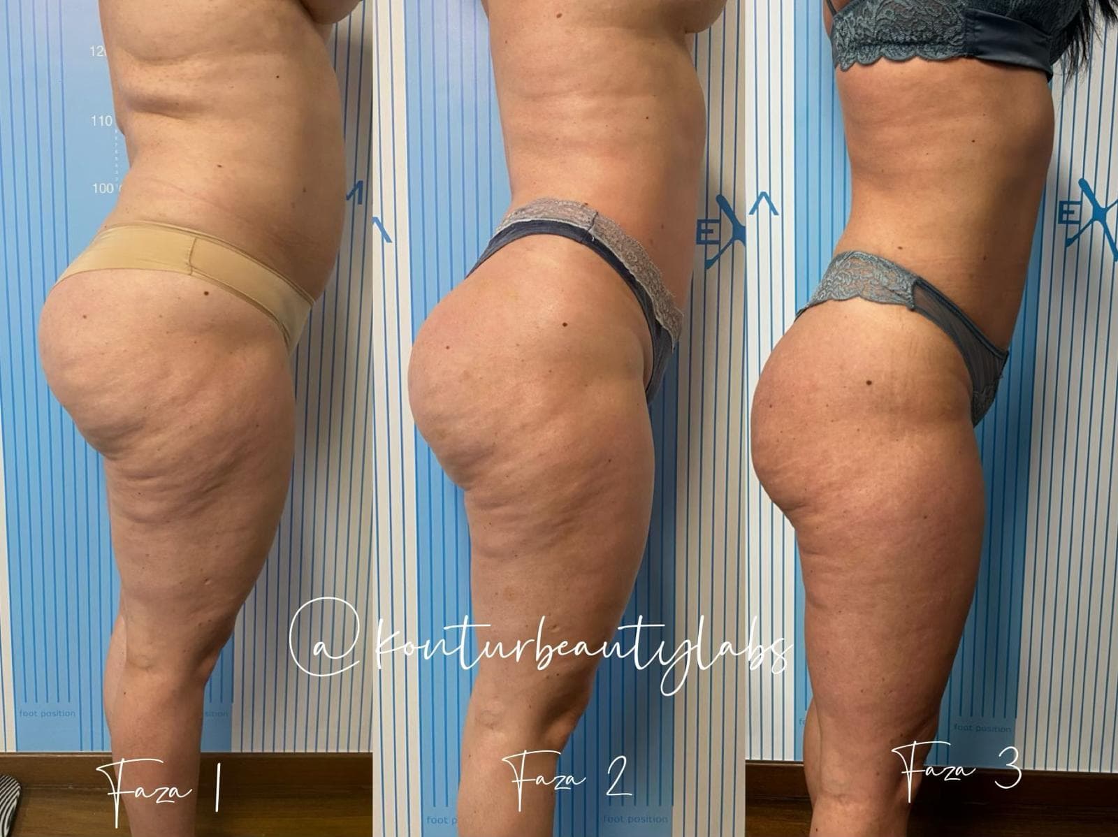 Tratament Eximia Bucuresti - 14