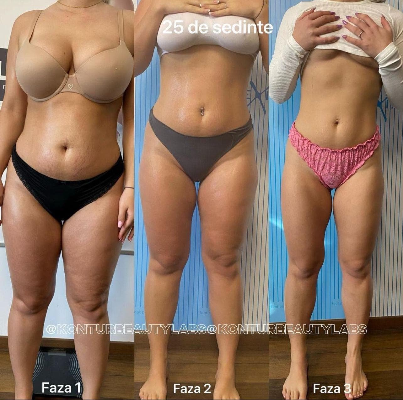 Tratament Eximia Bucuresti - 15