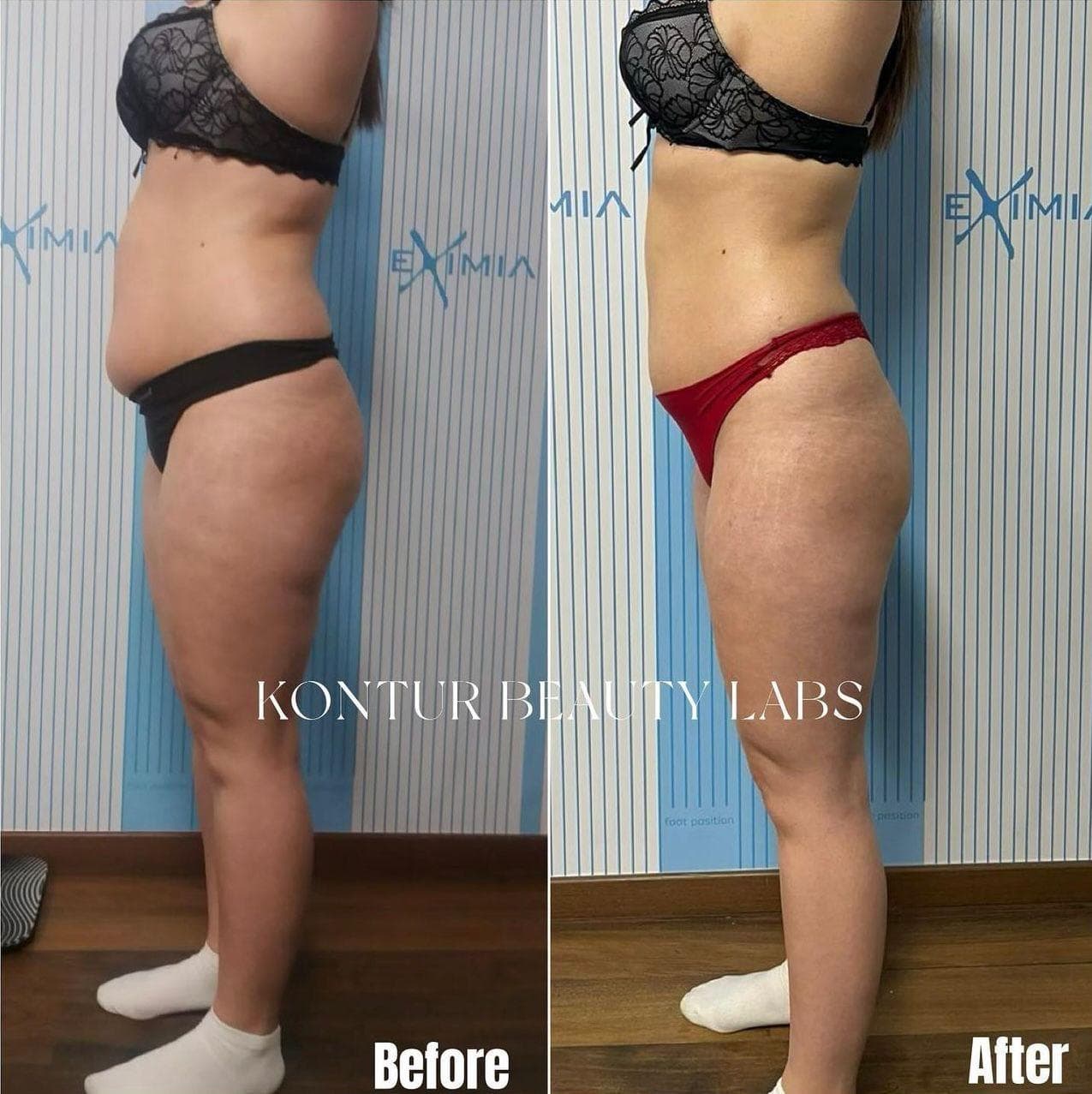 Tratament Eximia Bucuresti - 16