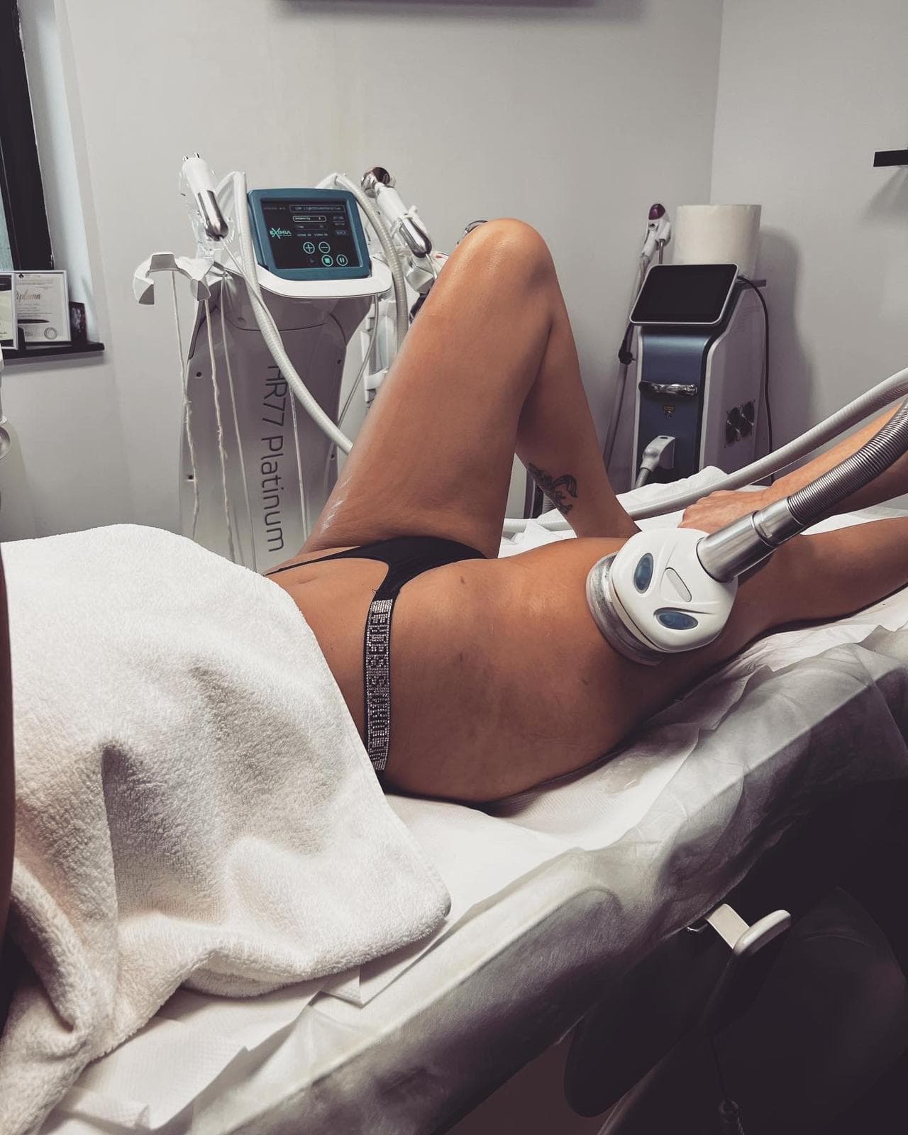 Tratament Eximia Bucuresti - 18