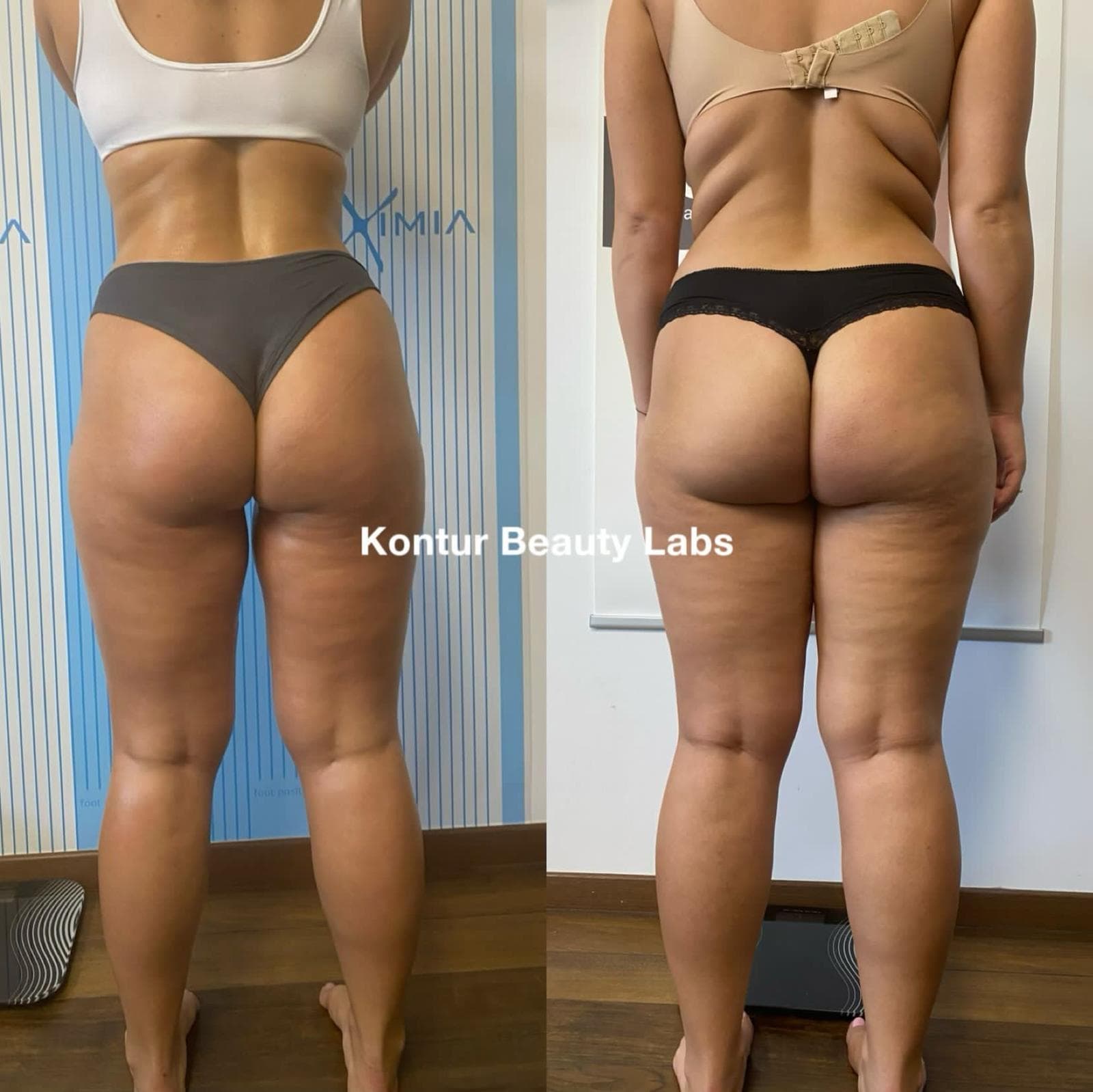 Tratament Eximia Bucuresti - 19