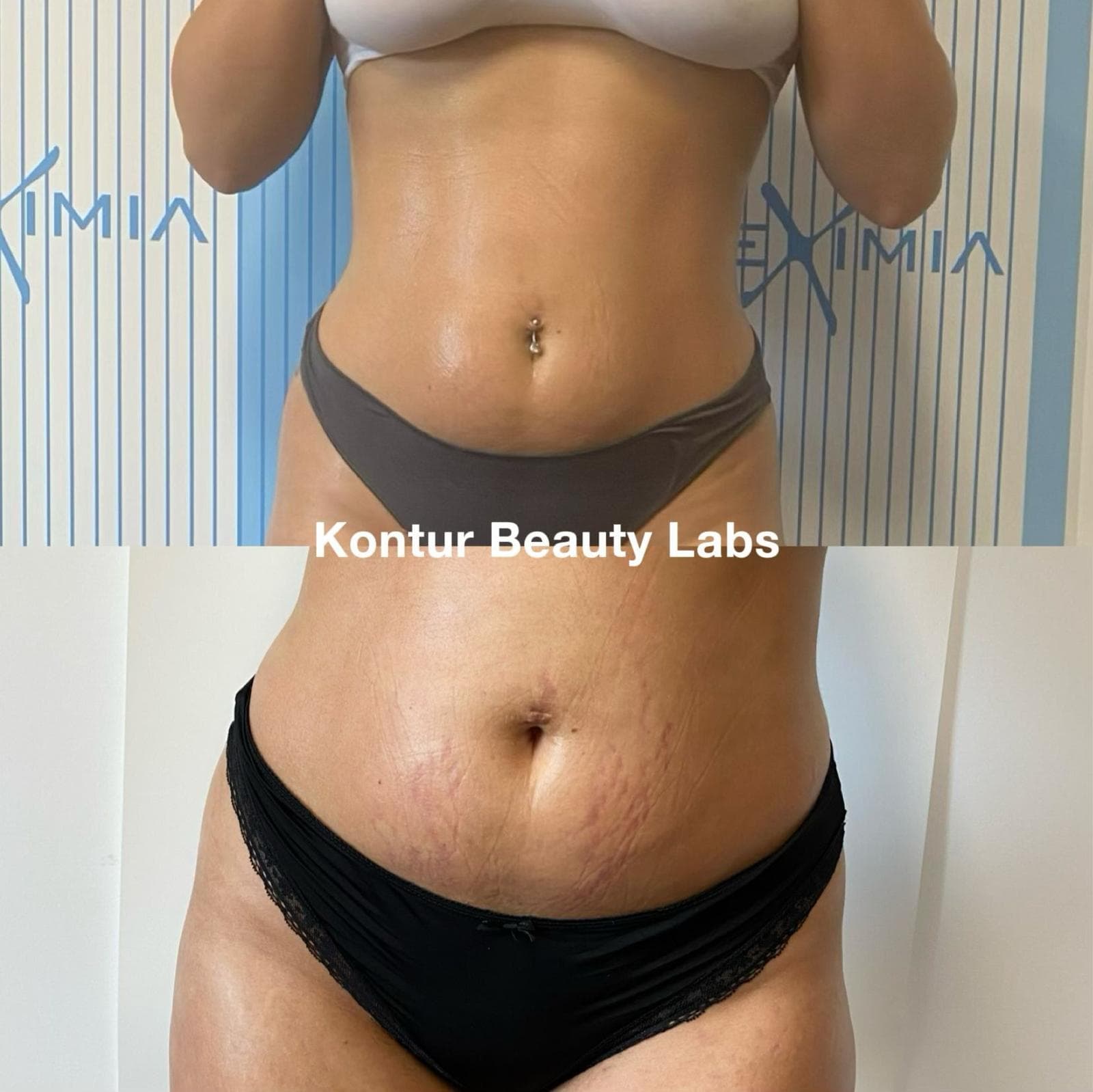 Tratament Eximia Bucuresti - 20