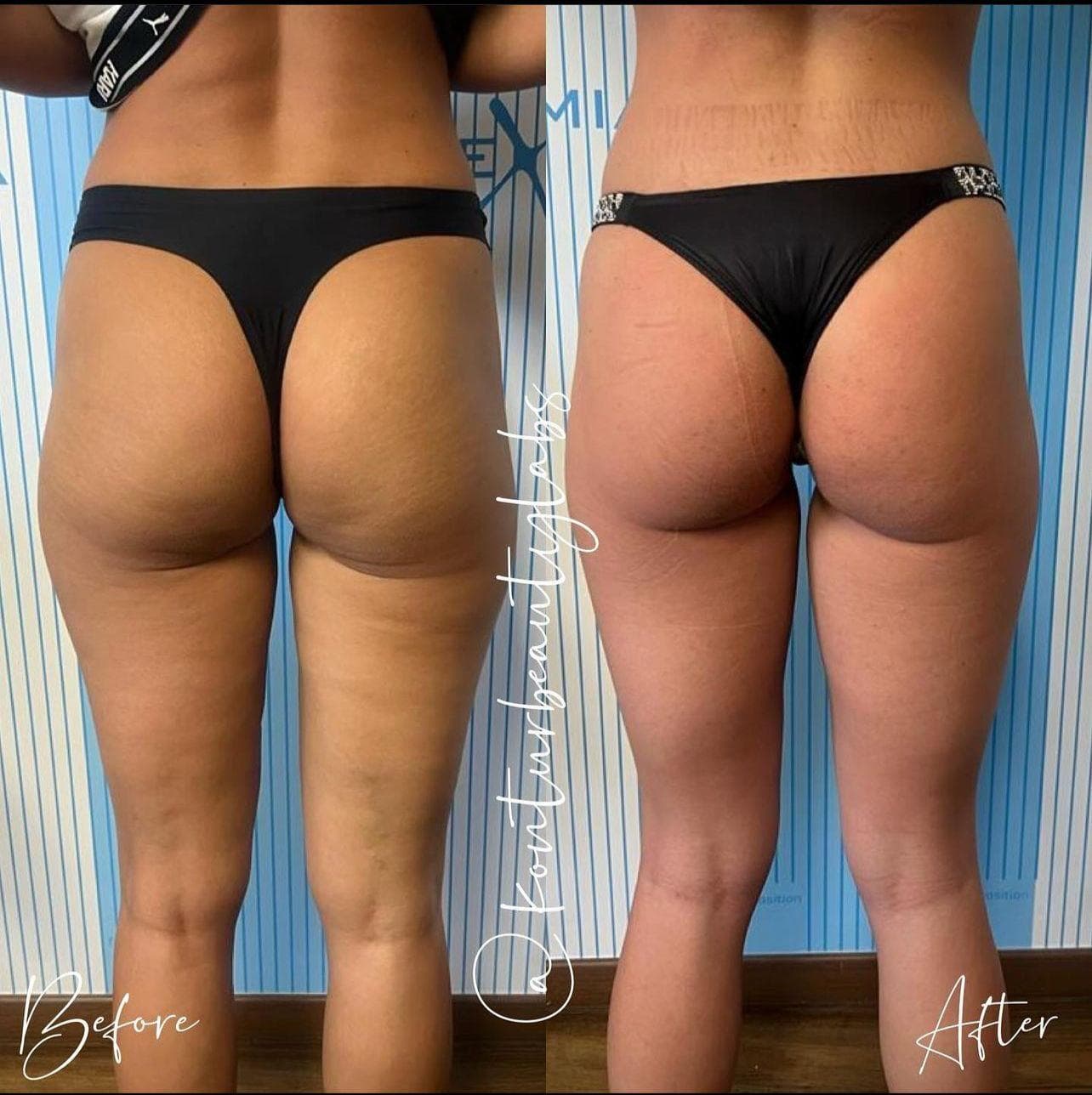 Tratament Eximia Bucuresti - 21