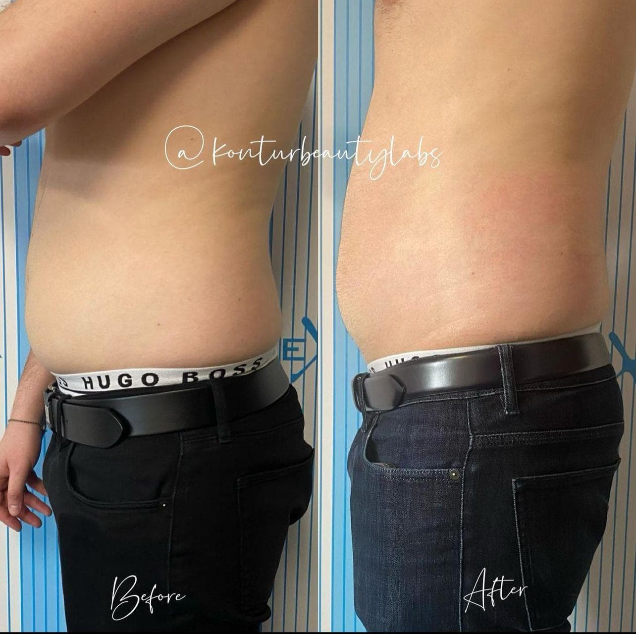 Tratament Eximia Bucuresti - 22