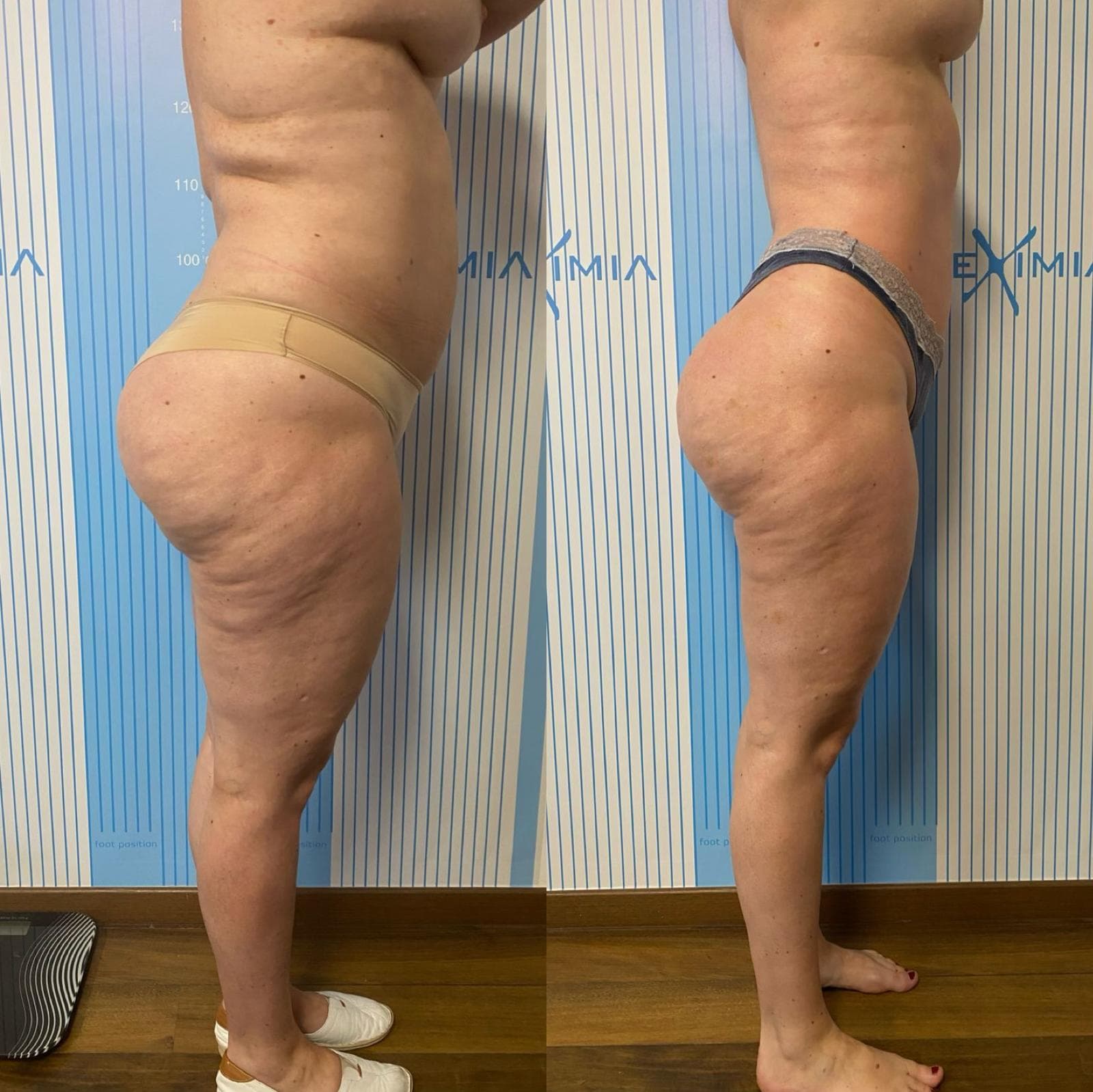 Tratament Eximia Bucuresti - 3