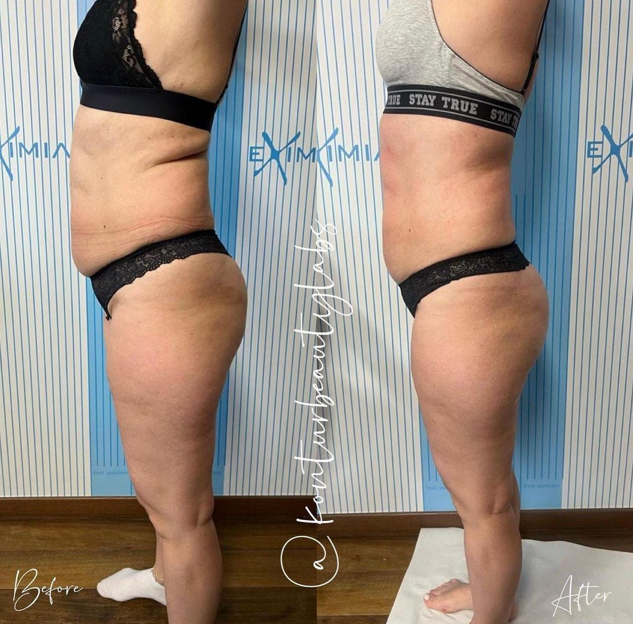 Tratament Eximia Bucuresti - 9