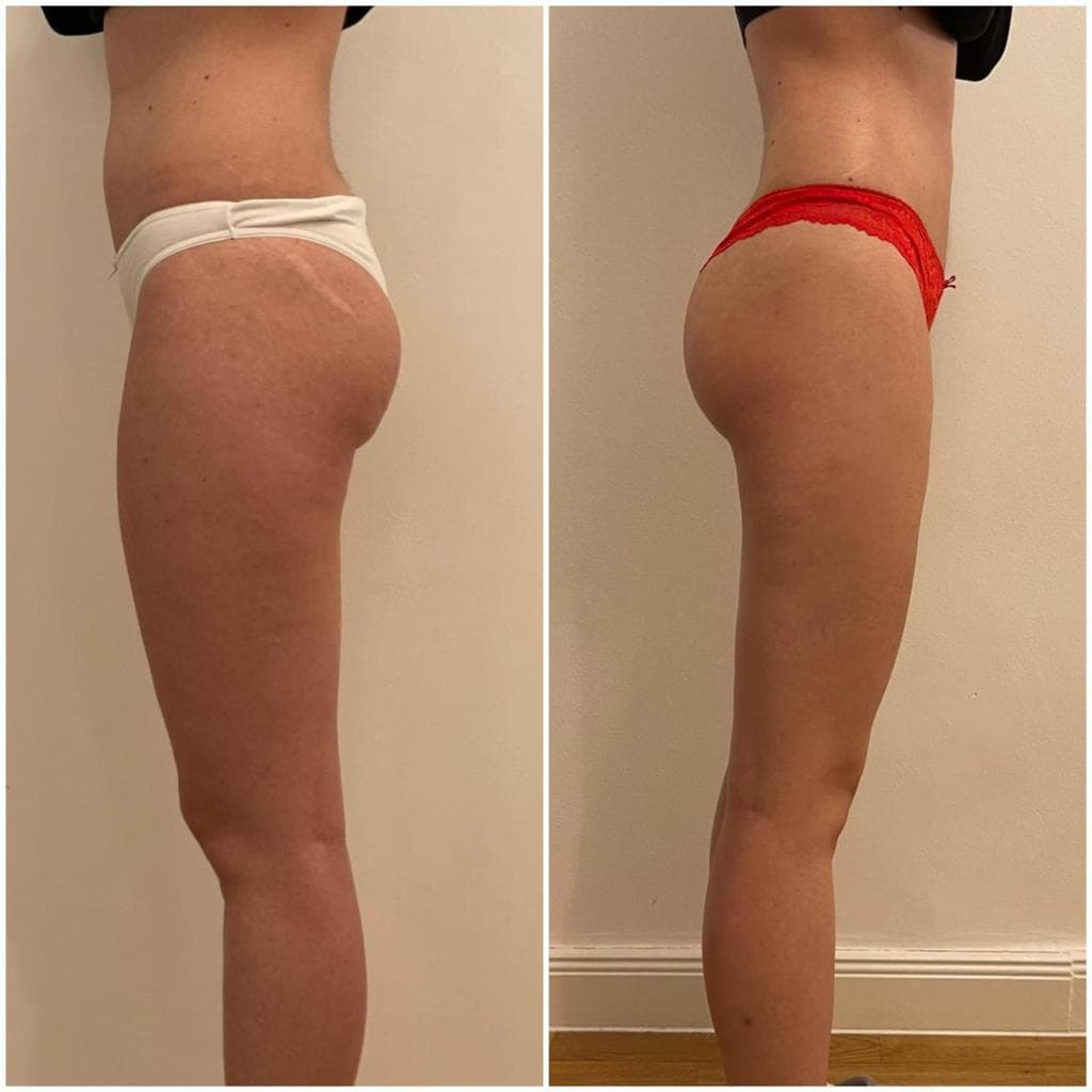 Zionic Treatment - 9