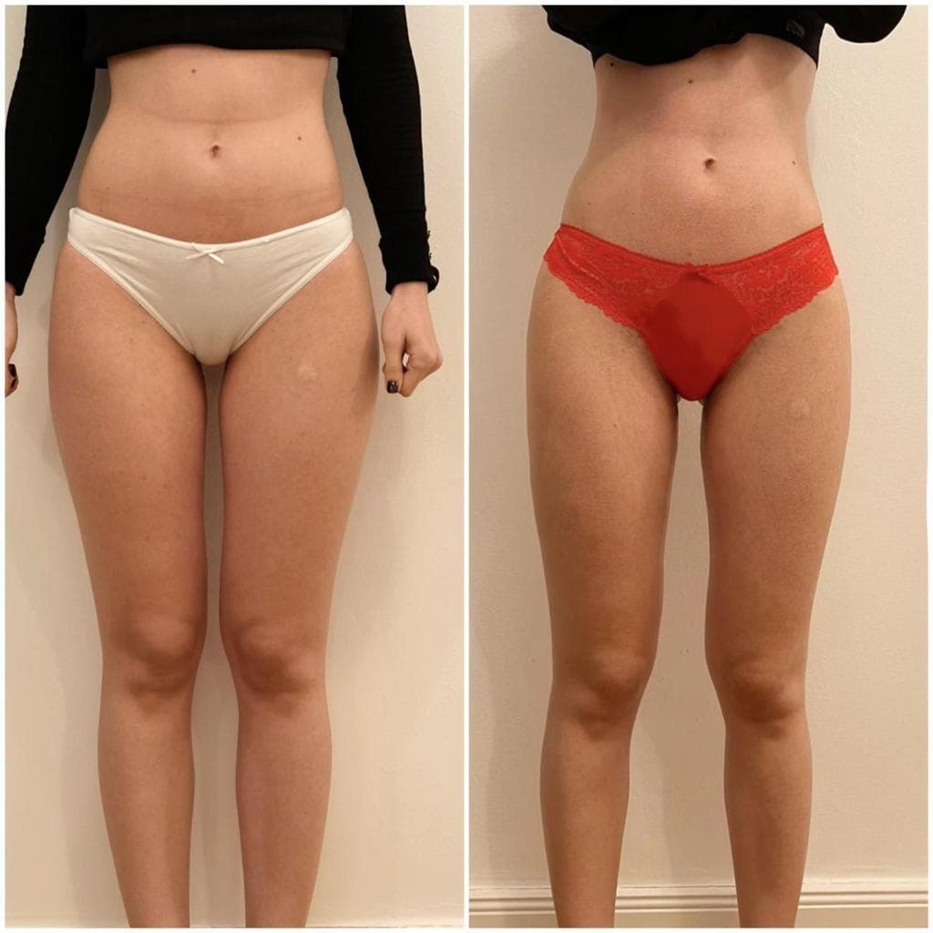 Zionic Treatment - 5