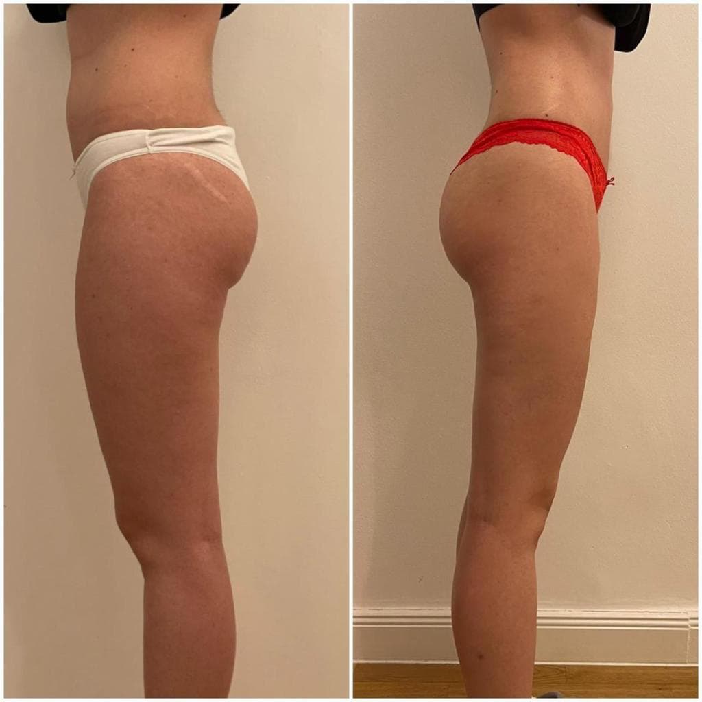 Zionic Treatment - 7