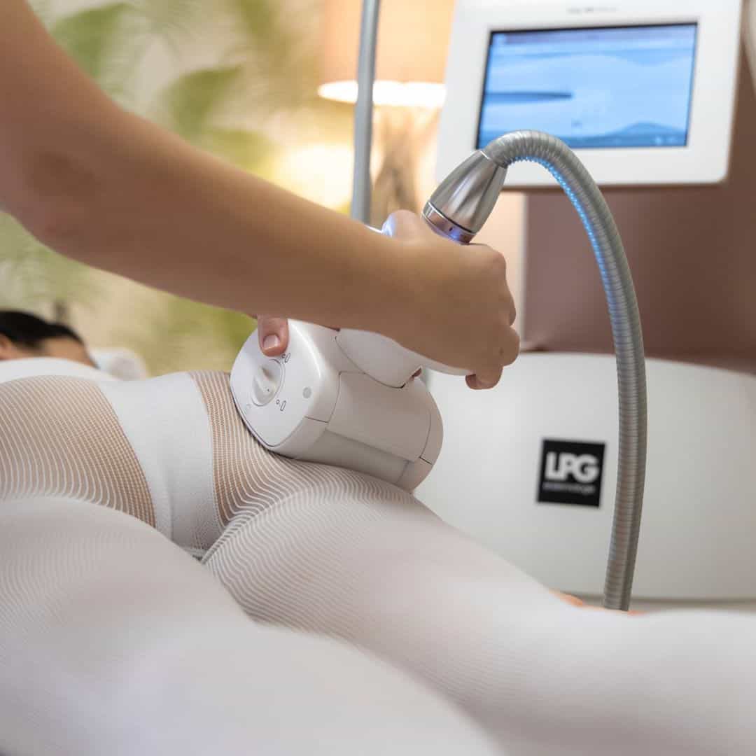 LPG endermologie