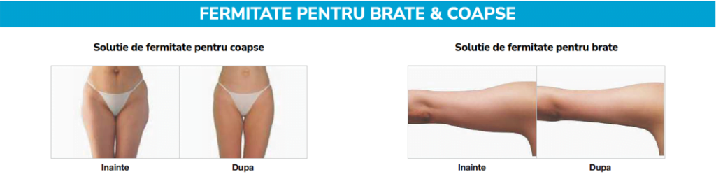X-Sculpt – Tonifiere musculară 13 X-Sculpt Tonifiere musculara fermitate pentru brate si coapse