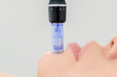 dermapen5