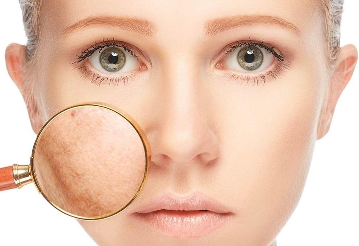 Oxigenare facială – Oxygenera Pro 4 oxygenare faciala oxygenera pro decebal