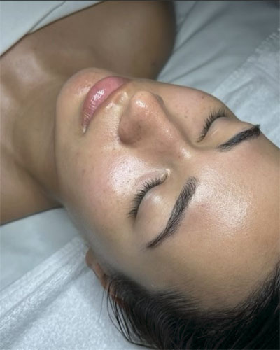 Oxigenare facială – Oxygenera Pro 14 oxygenera pro2