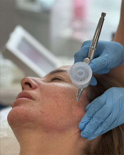 Oxigenare facială – Oxygenera Pro 15 oxygenera pro3