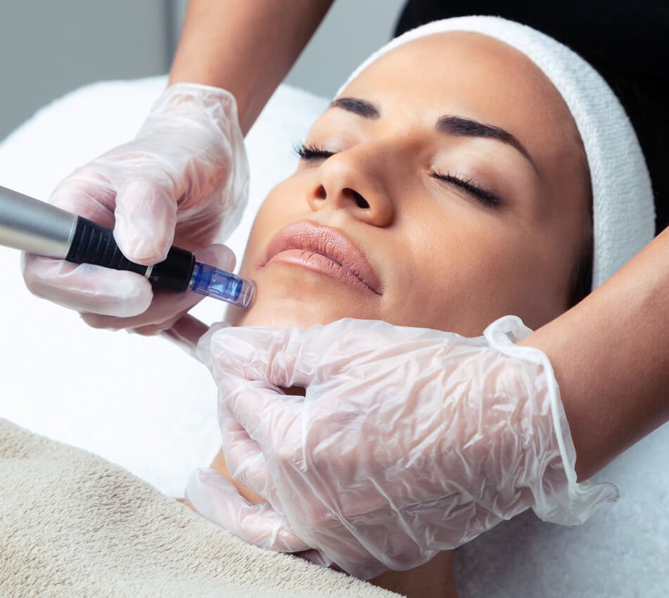 End of summer sale 9 dermapen3