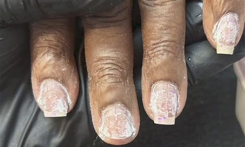 Reconstrucție unghie gel 8 reconstructie unghie gel3