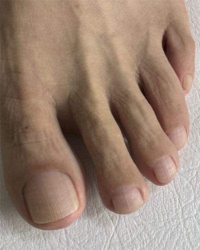 Pedichiură bărbați 8 pedichiura barbati3