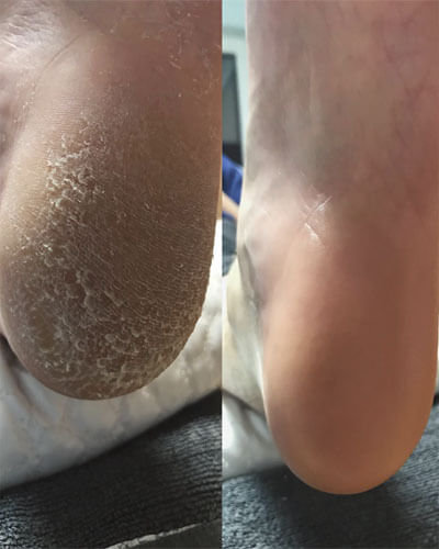 Pedichiură bărbați 9 pedichiura barbati4