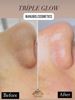 tratamente faciale19