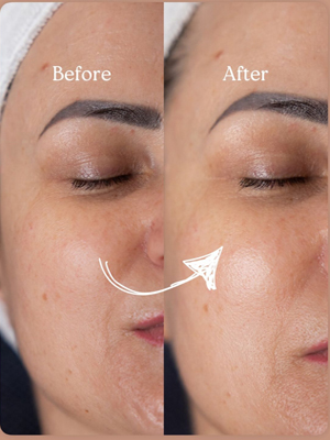 tratamente faciale20