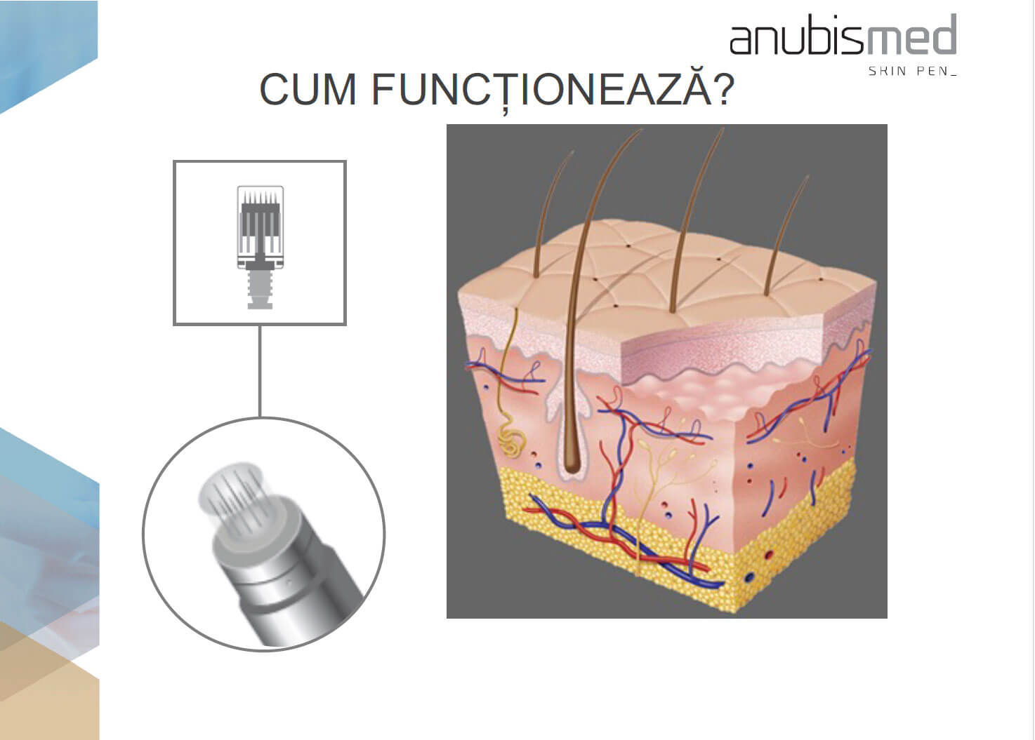 dermapen cum functioneaza?